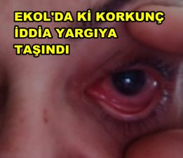 Ekol Göz hastanesi’nde korkunç İddia yargıya taşındı